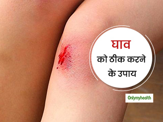 चोट या सर्जरी के घाव को जल्दी भरने में मदद करेंगे ये 5 प्राकृतिक तरीके